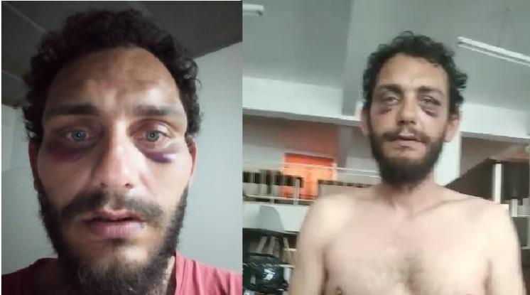 Ηράκλειο: Αστυνομικοί «σάπισαν» στο ξύλο Κρητικό γιατί τον πέρασαν για ... Πακιστανό