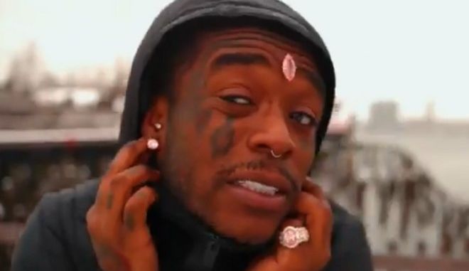 Lil Uzi Vert: Έχασε το διαμάντι των 24 εκατ. δολαρίων που είχε εμφυτεύσει στο μέτωπό του