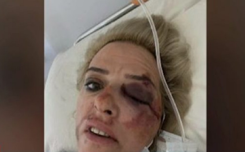 Επίθεση αδέσποτων σκύλων σε γυναίκα