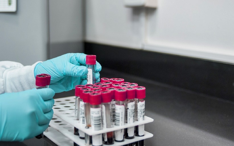 Ευλογιά των πιθήκων (mpox): Τι είναι, πώς μεταδίδεται, ποια είναι τα συμπτώματα